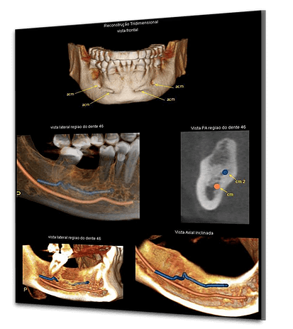 Fotos-3D-Odonto-X-Implantodontia