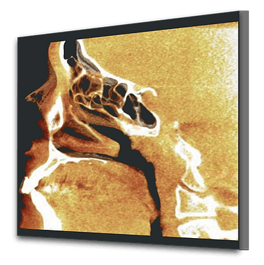 Fotos 3D Odonto X - paranasais
