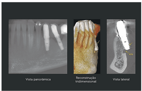 Fotos-3D-Odonto-X-Implantodontia