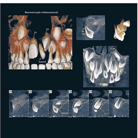 Documentação Odontológica em Itatiba – SP