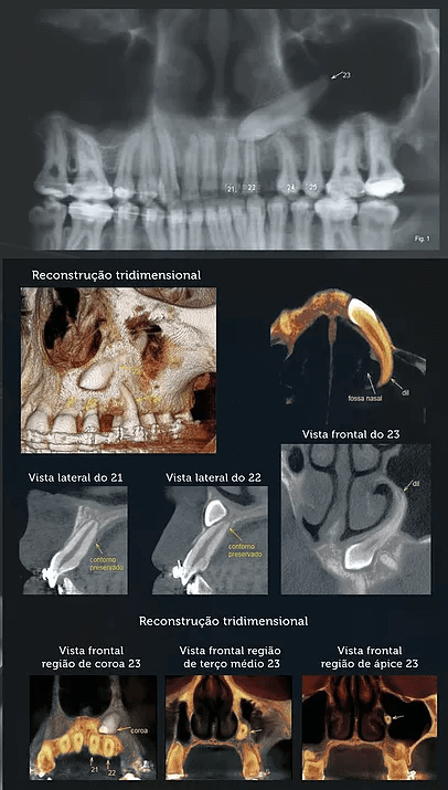 Documentação Odontológica em Itatiba – SP