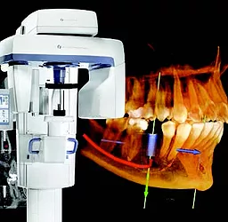 Tomografia Dentária em Itapeva – MG