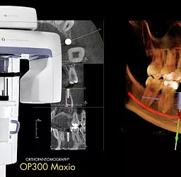 Tomografia Dentária em Monte Alegre do Sul – SP