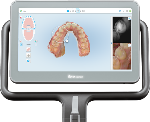 iTero Scanner Intra Oral em Itapeva – MG